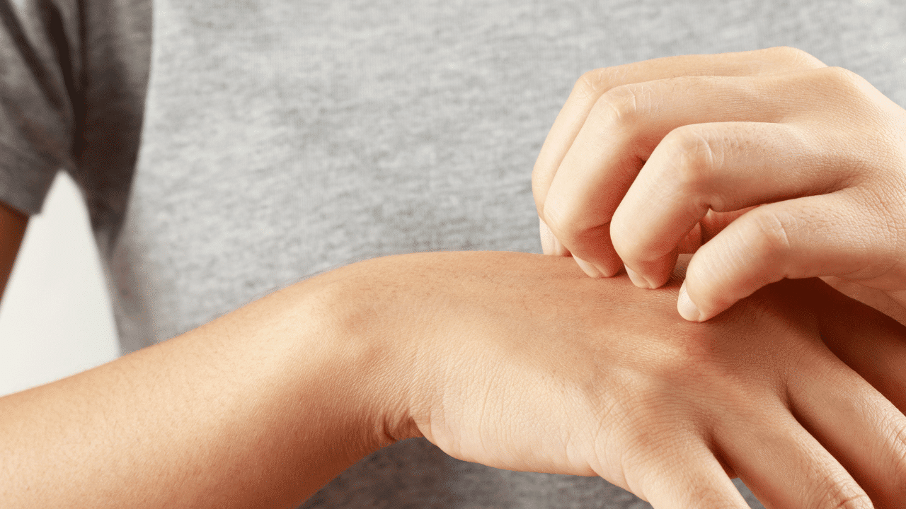 Puedo hacerme depilación láser si tengo dermatitis atópica